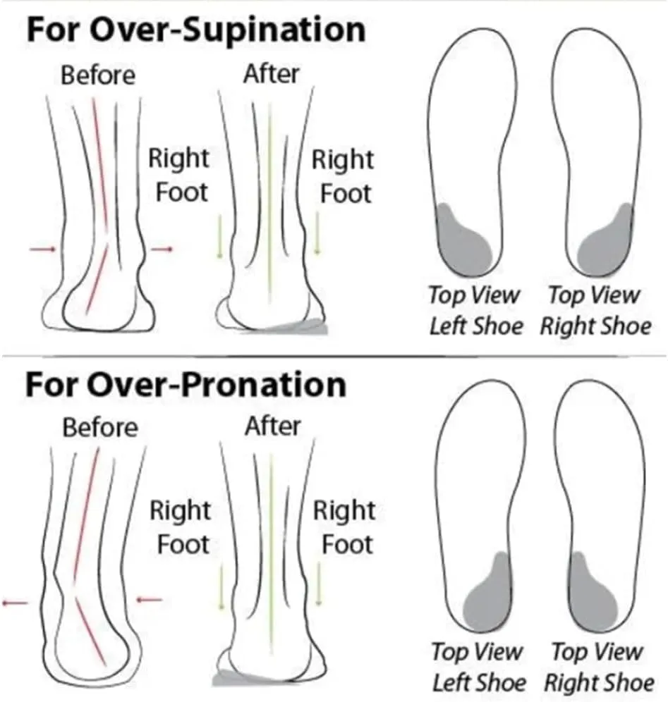 Women's Soft Sole Mesh Comfort Orthopedic Shoes-2025 New Slip on Walking Shoes with Arch Support Walking Shoes Comfort